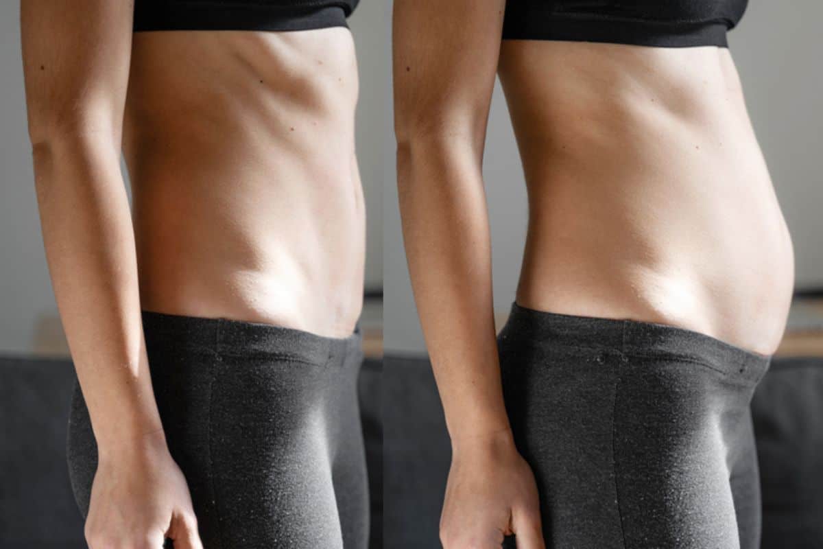 How long does diastasis recti take to improve Greater London (Barking and Dagenham)?