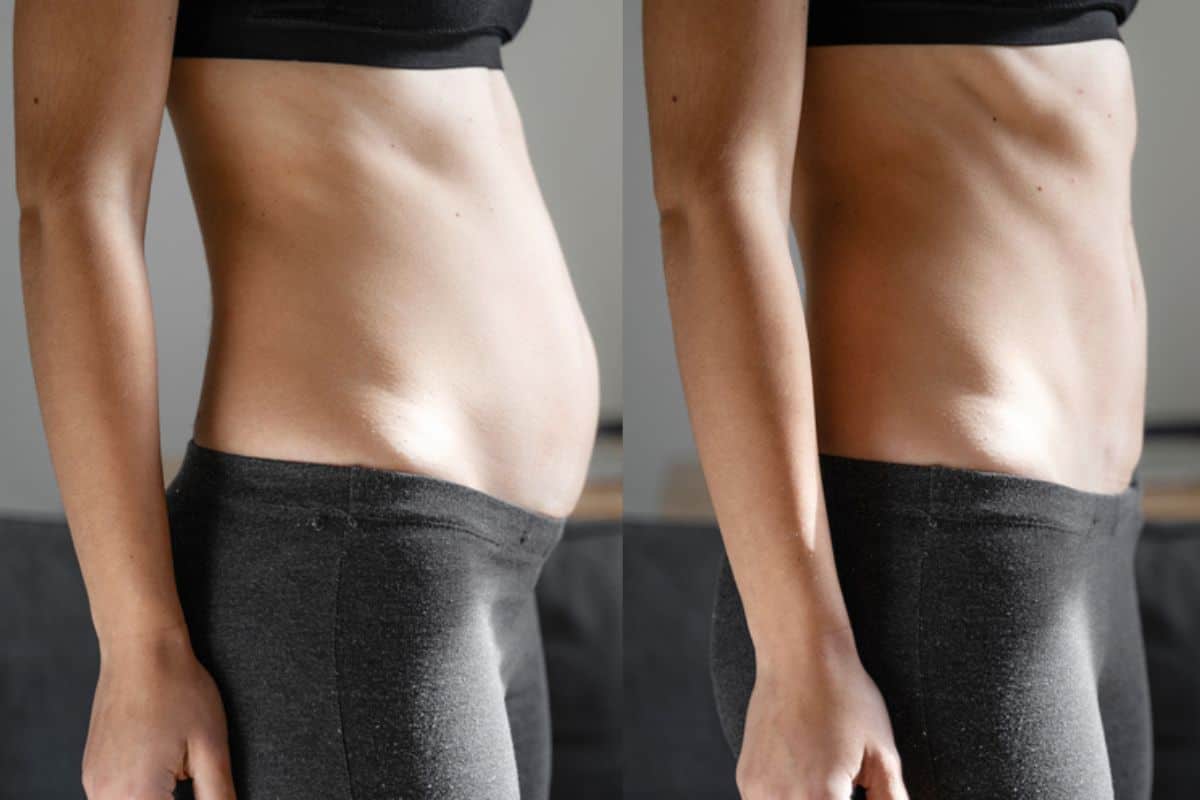 Post-Pregnancy: What Happens to Your Abdominal Muscles After Birth Greater London (Barking and Dagenham)