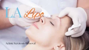 Woman receiving Actinic Keratosis Removal Treatment Greater London (Barking and Dagenham)