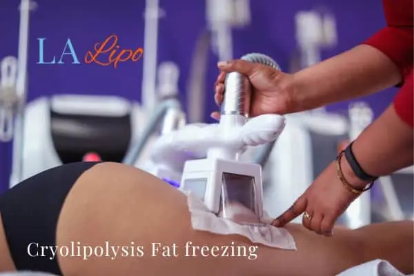 women getting fat freezing Greater London (Barking and Dagenham)