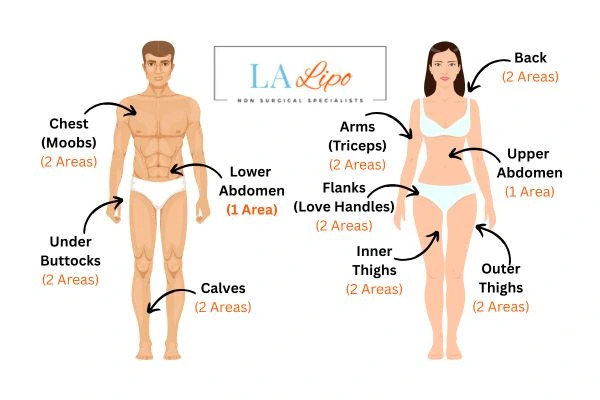 LA LIPO Cryolipolysis Areas Greater London (Barking and Dagenham)