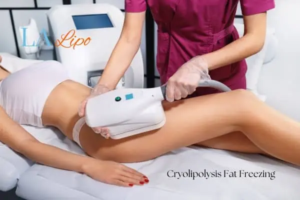 Woman receiving coolsculpting Greater London (Barking and Dagenham) treatment on her thighs