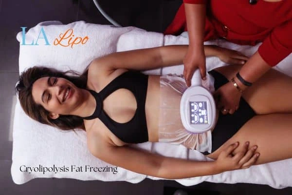 woman getting cryolipolysis Greater London (Barking and Dagenham)