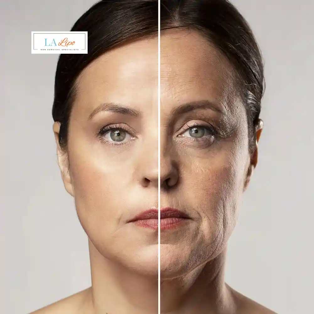 How Can You Tell If Non-Surgical Skin Tightening Is Right for You Greater London (Barking and Dagenham)?