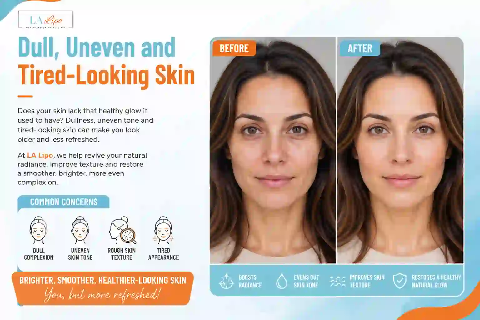 Sign #5: Dull, Uneven and Tired-Looking Skin Greater London (Barking and Dagenham)
