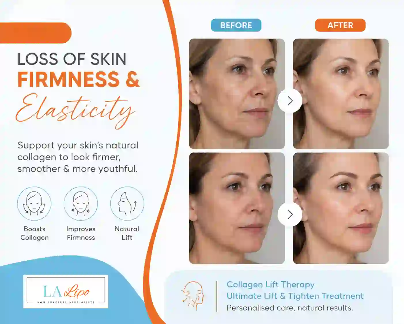 Sign #7: Loss of Skin Firmness and Elasticity Greater London (Barking and Dagenham)